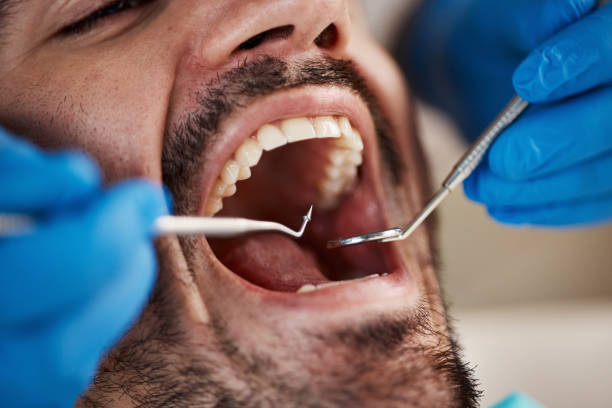 Best Emergency Denture Repair in Crittenden, KY