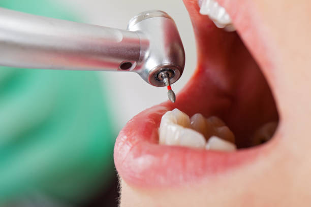 Best Emergency Gum Treatment in Crittenden, KY